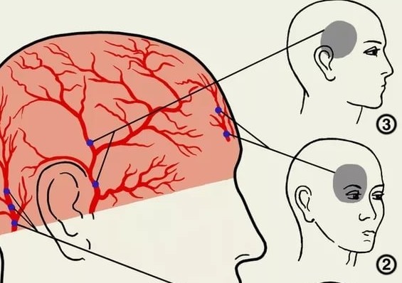 Болят глаза и голова горячая