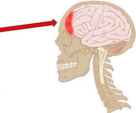 болит голова несколько дней подряд в лобовой части