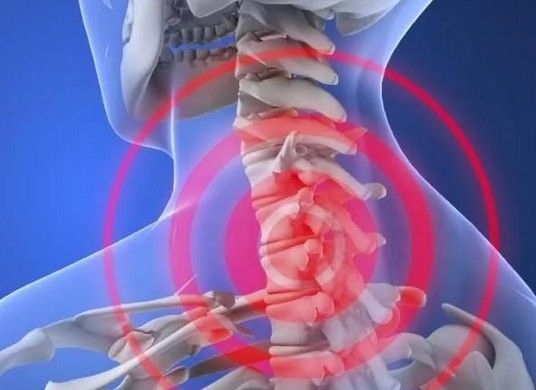 почему болит шея и лоб головы