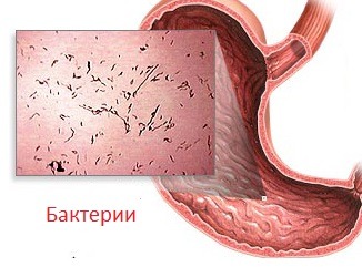 Рвет болит голова и болит желудок что это