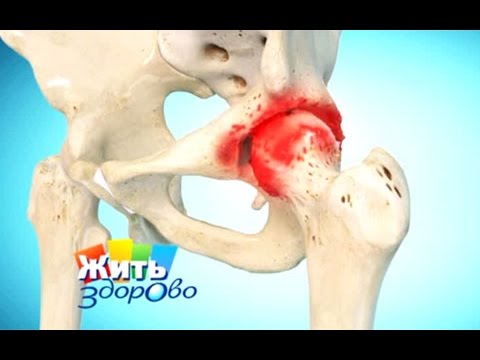 Болит спина кости таза