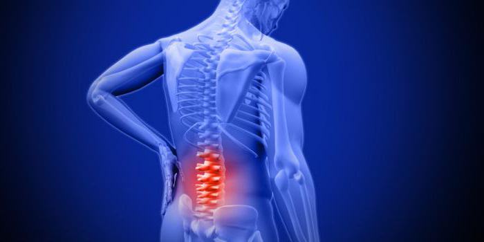 Боль в пояснице отдает в правую ногу
