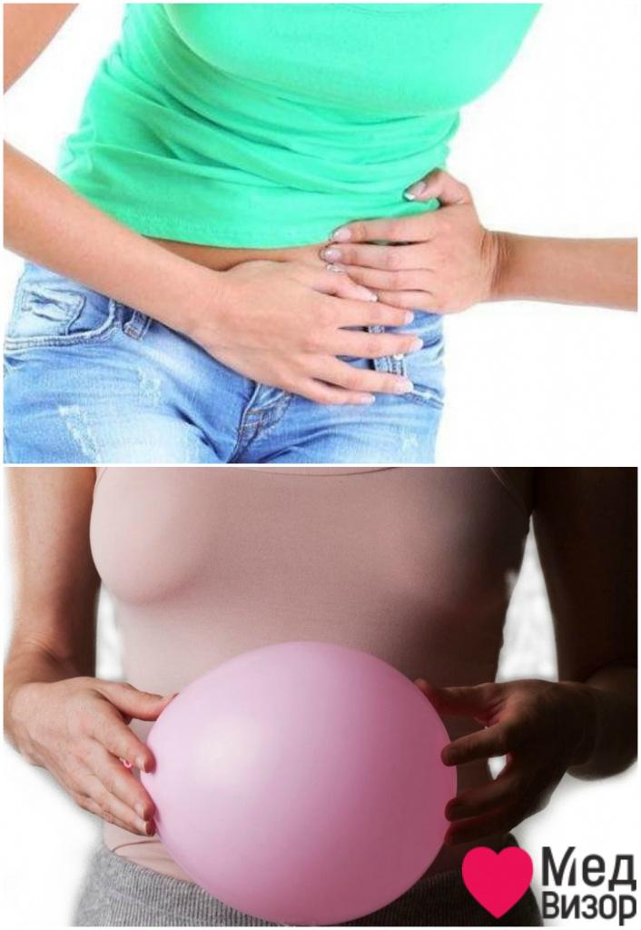 Дивертикулез симптомы: боли в нижней левой части живота, могут отдавать в спину; вздутие живота Почему болит спина и понос