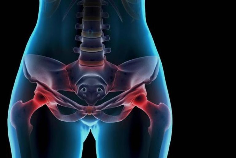 Боль в тазовых костях.