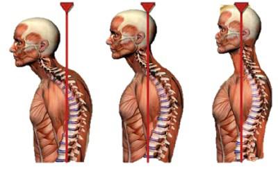 боли в грудном отделе позвоночника ночью