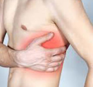 Что делать при ушибе ребра?