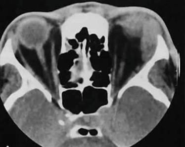 Болит спина в области позвоночника температура
