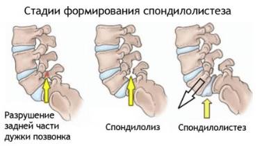 Болит спина ночью повернутся больно