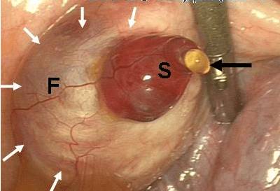 Болит низ спины у женщины в середине цикла