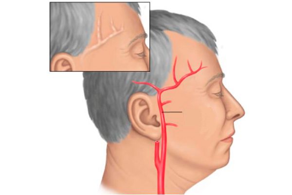 Болит голова и спина таблетки не помогают