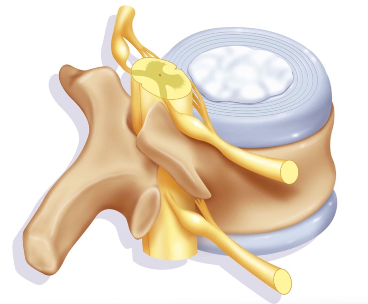 Как выглядит межпозвоночный диск