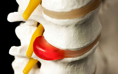 почему болит спина в грудном отделе по ночам