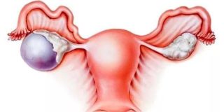 Болит ниже спины отдает правую ногу в пах