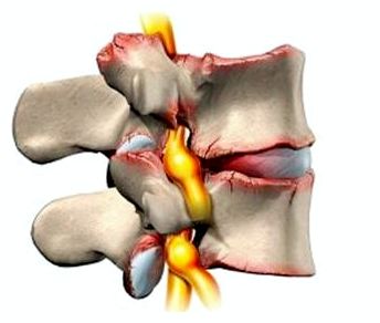 почему болит спина в грудном отделе по ночам