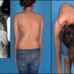 Если болит в грудной клетке посередине и отдает в спину что это может быть