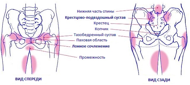 Схема боли в области таза при беременности