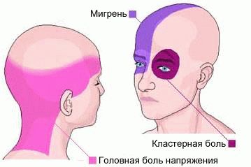 Болит голова и спина таблетки не помогают